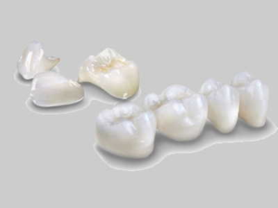 3M dental crown