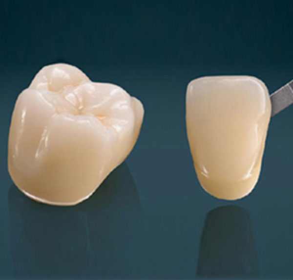 3M Lava Monolith Zirconia Crowns South Delhi India