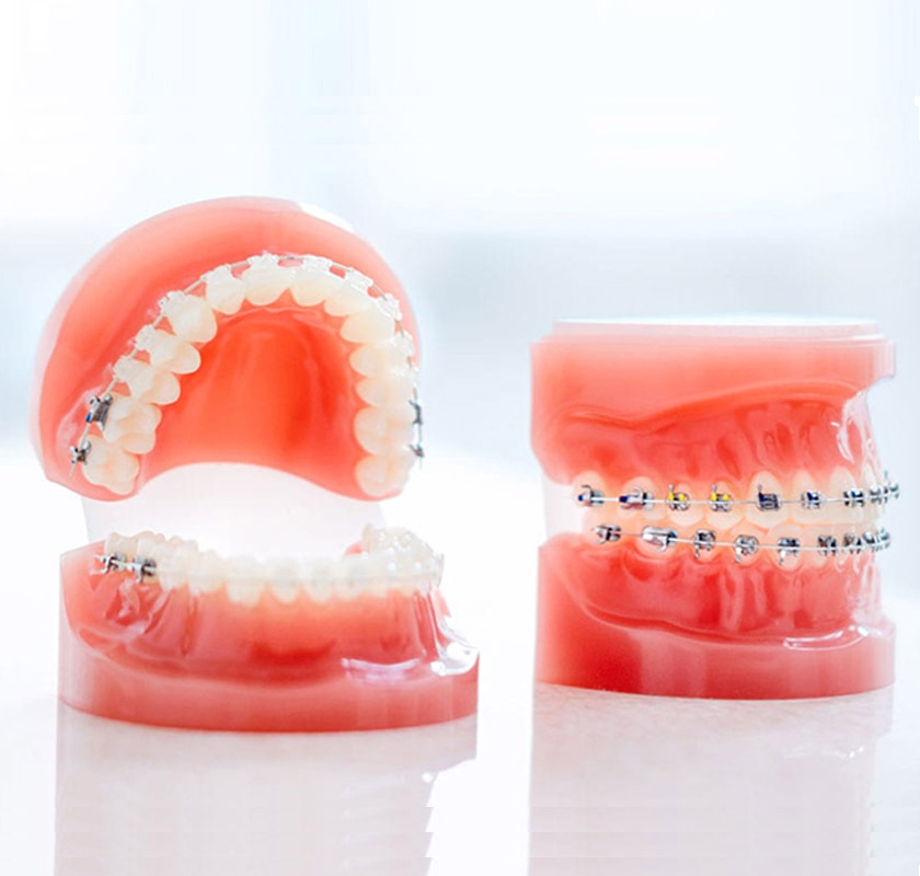 Best Orthodontist South Delhi Top Braces Specialist India